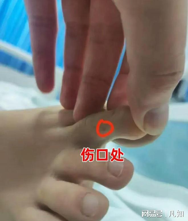 熊猫体育资讯：27岁女孩被蛇咬身亡后续：生活照曝光家属透露更多细节官方通(图6)